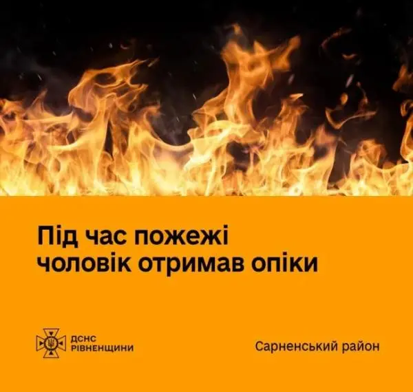 На Рівненщині чоловік отримав опіки внаслідок пожежі