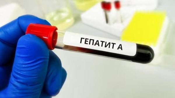 На Рівненщину передали тести на гепатит А, УЗД-системи та наркозні апарати з Німеччини - INFBusiness